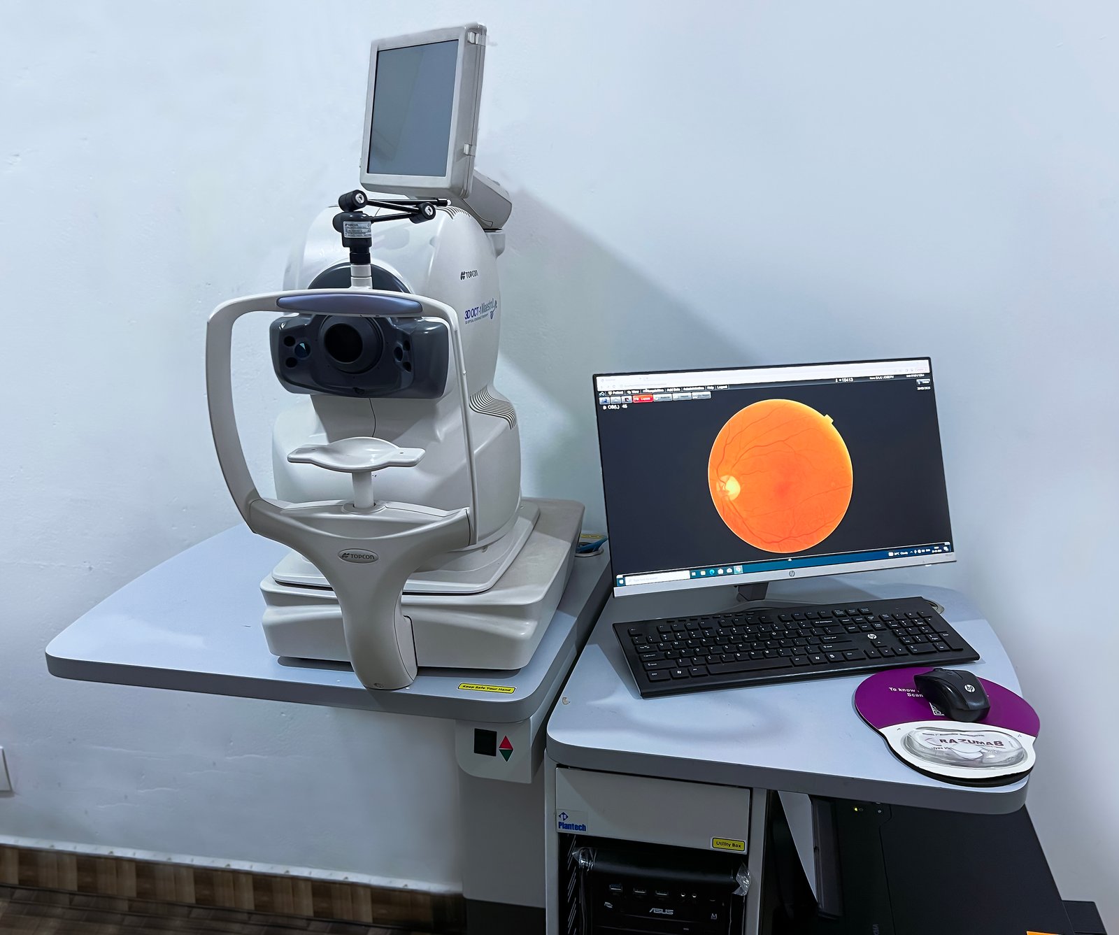 3D Optical Coherence Tomography Device 3doct-1 Maestro2